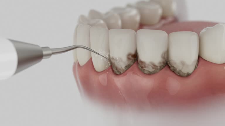 Reliable Tooth Extraction contractor in Washington County County, OK by Dentist Open Now